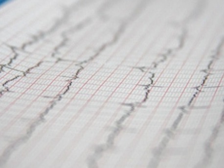 Electrocardiograma ECG - YRISH Technology